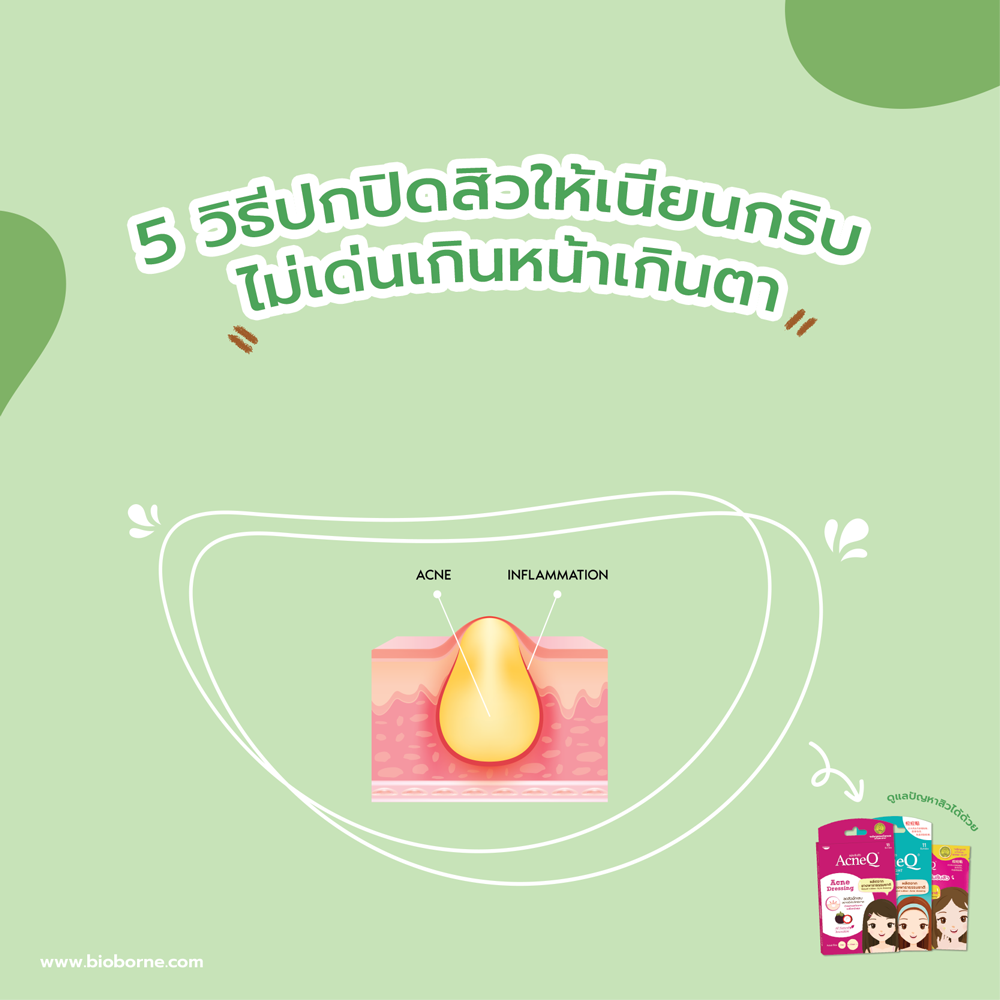 5 วิธีปกปิดสิวให้เนียนกริบ ไม่เด่นเกินหน้าเกินตา
